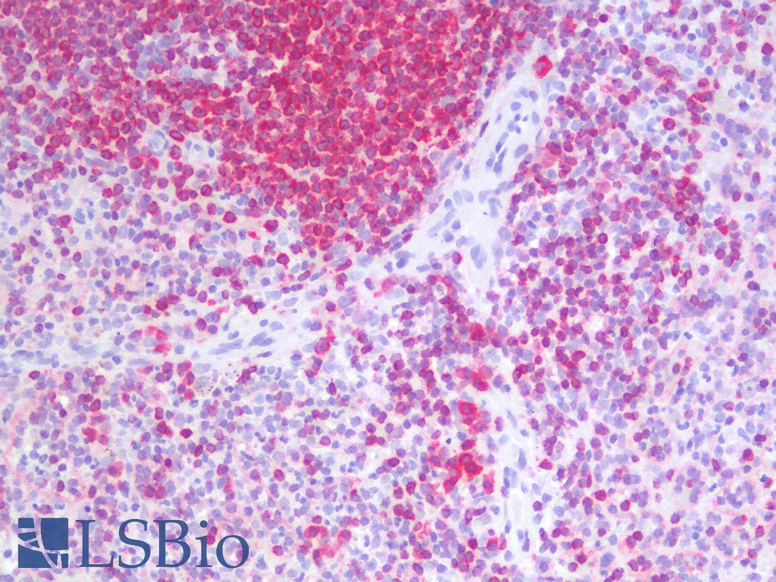 PathPlus™ BCL2 / Bcl-2 Antibody (clone rBCL2/796)