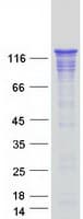 Human WDHD1 Protein (Recombinant Myc-DDK (Flag))