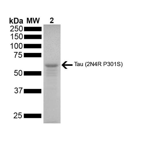 Human MAPT / Tau Protein (Recombinant)