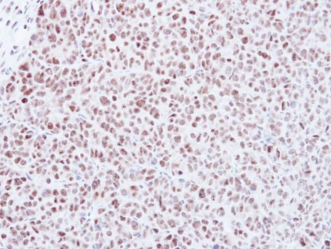 Polyclonal Rabbit anti-Human MAD2L1 / MAD2 Antibody (aa142-205, IHC, WB)