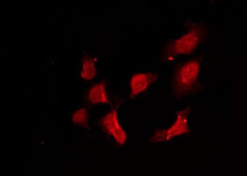 Polyclonal Rabbit anti-Human RRAD Antibody (IHC, IF, WB)