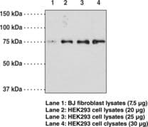 IHC-plus™ OPTN / Optineurin Antibody (aa575-591)