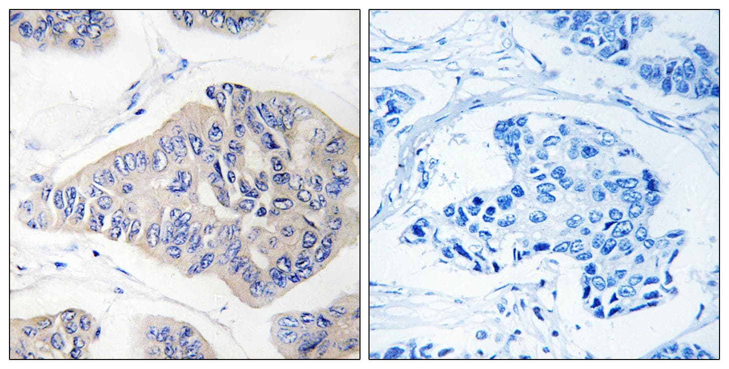 Polyclonal Rabbit anti-Human NDUFS1 Antibody (IHC, WB)