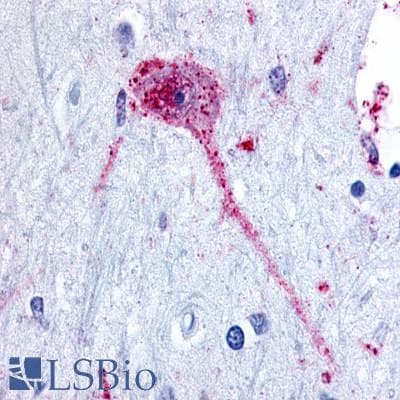 PathPlus™ Polyclonal Rabbit anti-Human NPBWR1 / GPR7 Antibody (Cytoplasmic Domain, IHC)