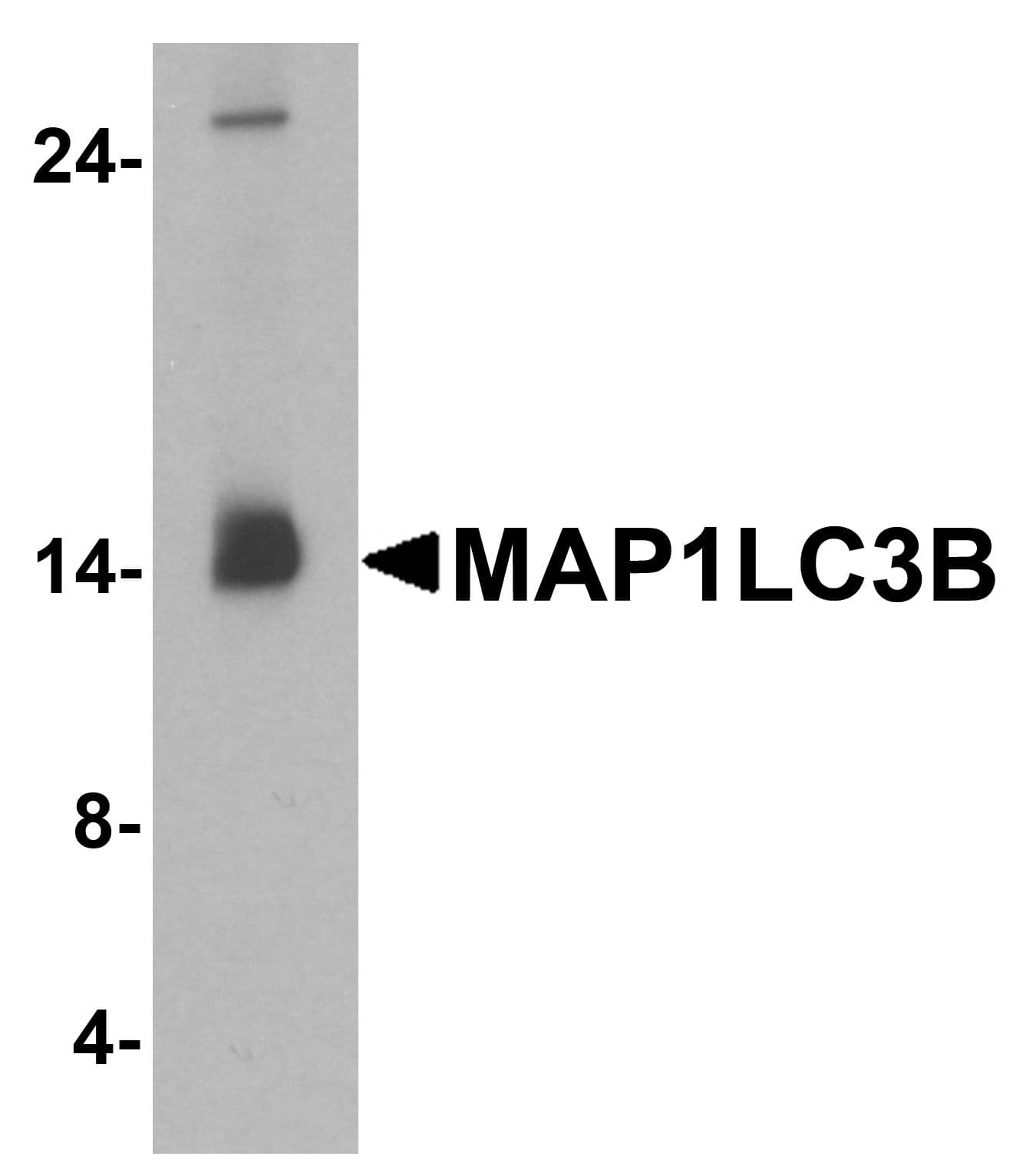 IHC-plus™ MAP1LC3B / LC3B Antibody