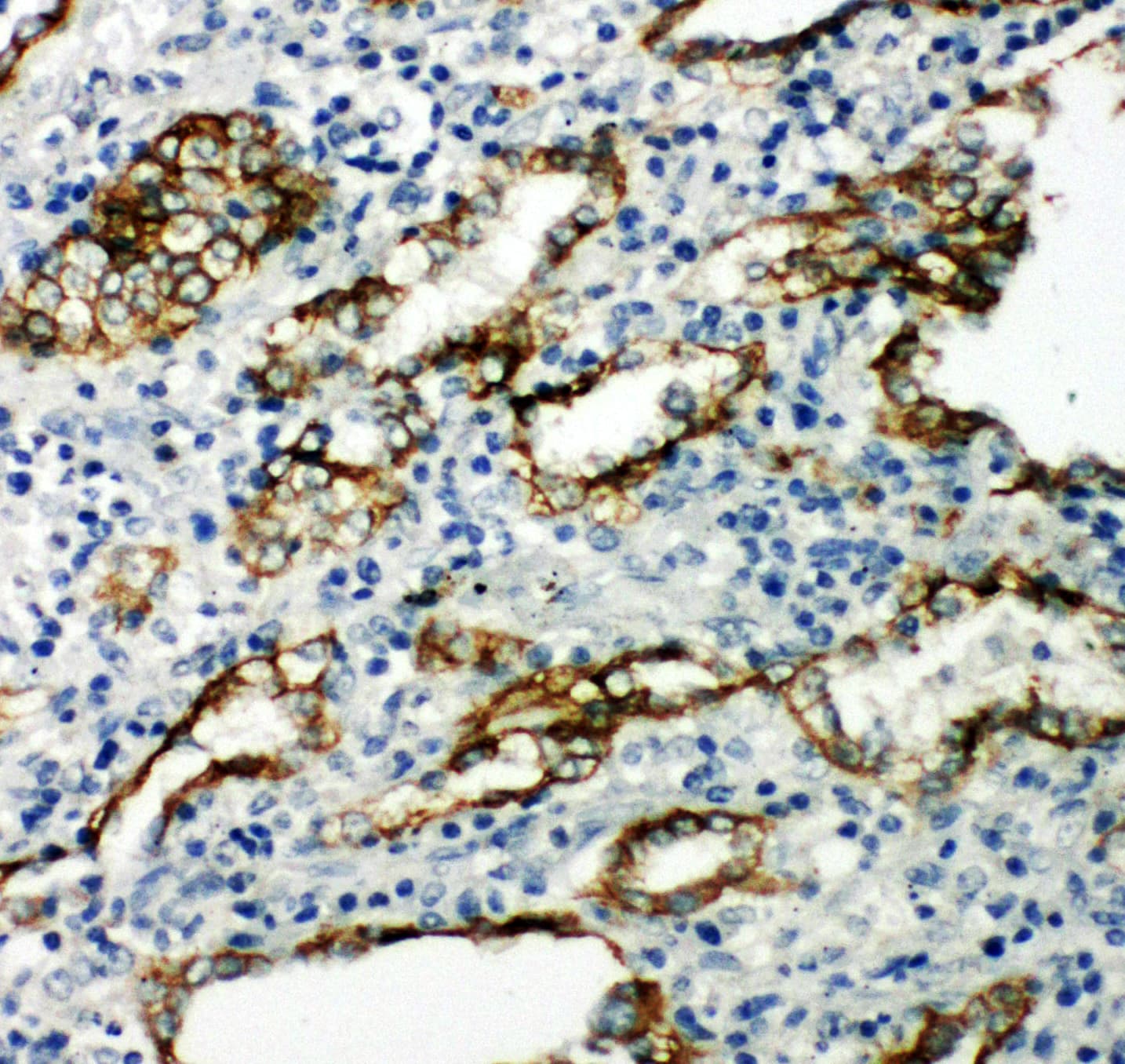 Polyclonal Rabbit anti-Human AQP4 / Aquaporin 4 Antibody (aa258-274, IHC, WB)