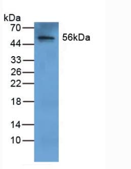 FGB / Fibrinogen Beta Chain Antibody (aa55-118)