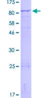 Human ZNF567 Protein (Recombinant GST)