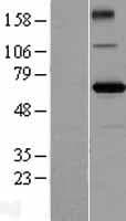 ZBTB2 Protein (Over-Expression Lysate Myc-DDK (Flag))