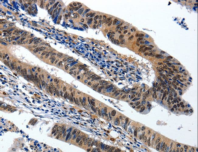 BCL2 / Bcl-2 Antibody