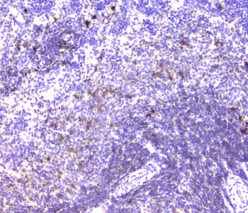 Polyclonal Rabbit anti-Human IGLL1 / CD179b Antibody (IHC, WB)