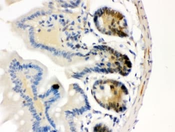 Polyclonal Rabbit anti-Human CDK4 Antibody (IHC, WB)