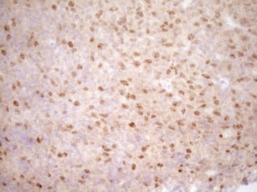 TRB3 / TRIB3 Antibody (aa1-200, clone OTI1F6)