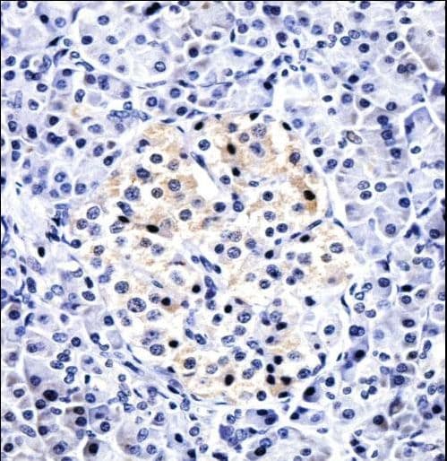 CCL15 / MIP5 Antibody (aa71-100)