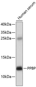 CXCL7 / PPBP Antibody