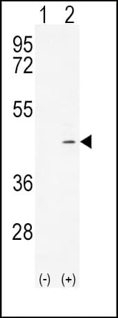 ADH4 Antibody (aa319-348)