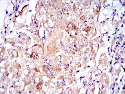 PKN2 Antibody (clone 1D1)