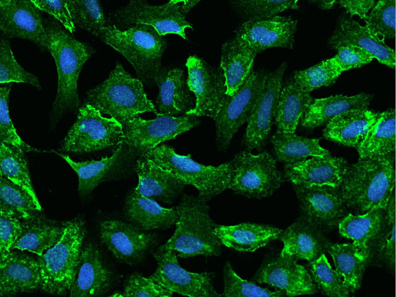 Polyclonal Rabbit anti-Human C1orf27 Antibody (IF)