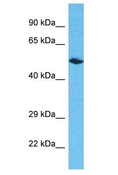 Polyclonal Rabbit anti-Human ERCC6L2 Antibody (aa132-181, WB)