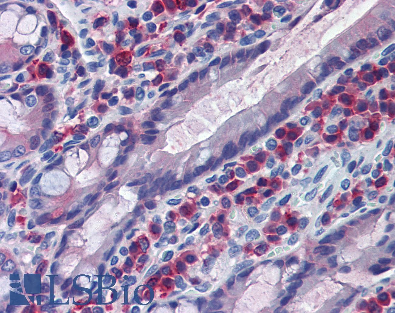 PathPlus™ Monoclonal Mouse anti-Rat CD163 Antibody (clone ED2, IHC)