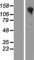 ARHGAP45 Protein (Over-Expression Lysate Myc-DDK (Flag))