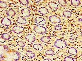 Polyclonal Rabbit anti-Human HAUS6 / FAM29A Antibody (aa676-955, IHC)