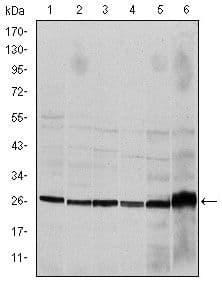 CASP8 / Caspase 8 Antibody (clone 1H11)