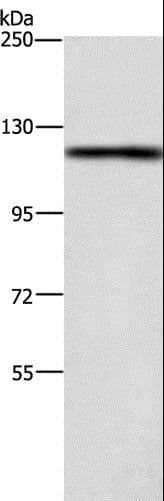 TSPYL2 / DENTT Antibody