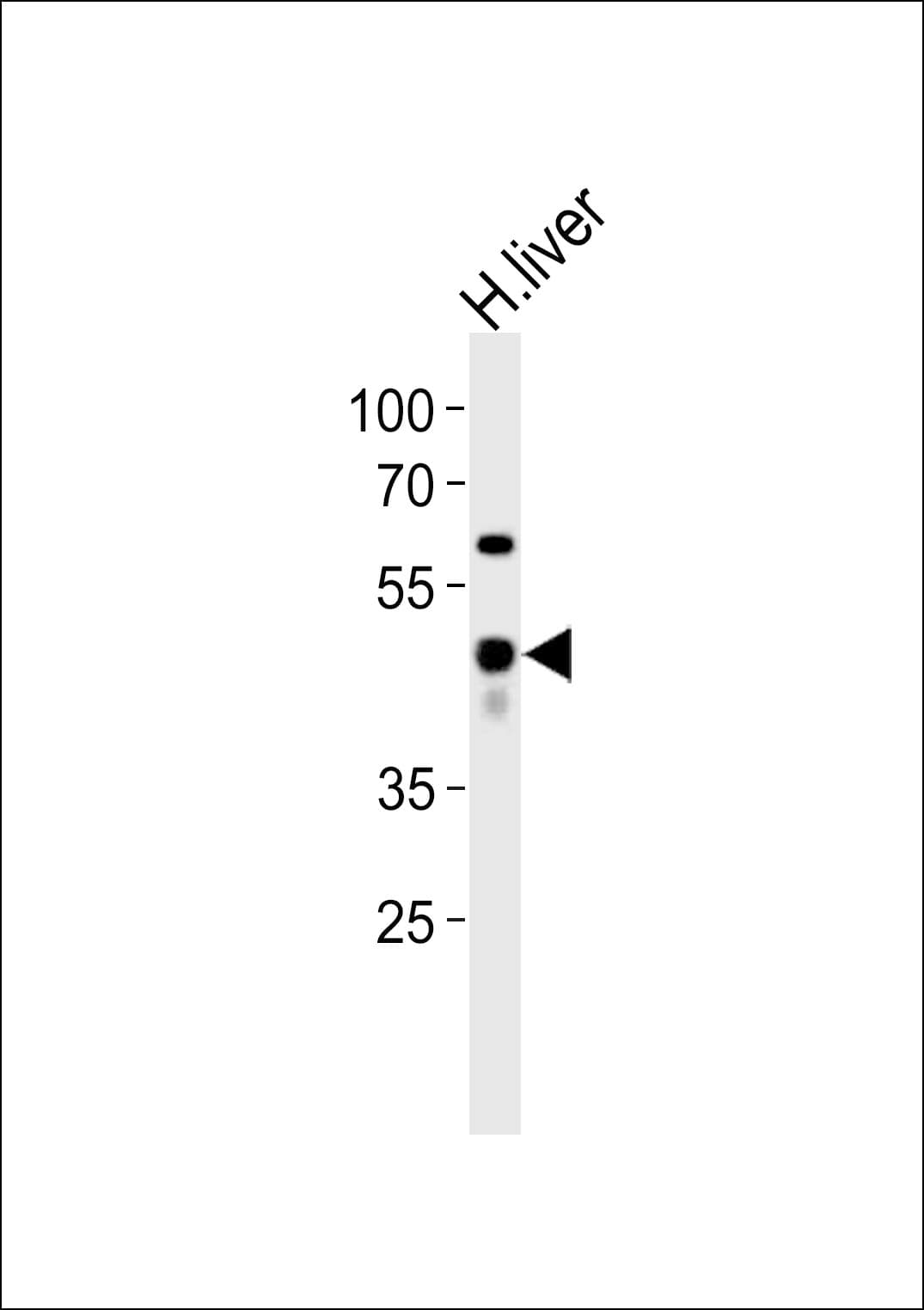 Polyclonal Rabbit anti-Human SERPINE1 / PAI-1 Antibody (aa323-357, WB)