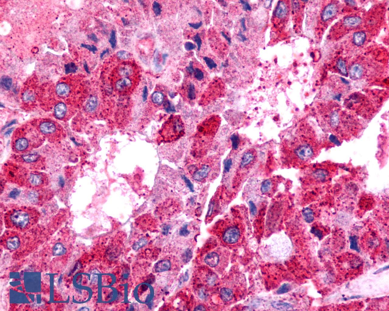 PathPlus™ Polyclonal Rabbit anti-Human TPRA1 / GPR175 Antibody (N-Terminus, IHC)
