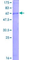 Human CXCR6 Protein (Recombinant GST)