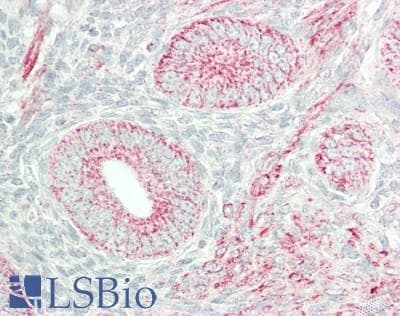 IHC-plus™ NIP3 / BNIP3 Antibody