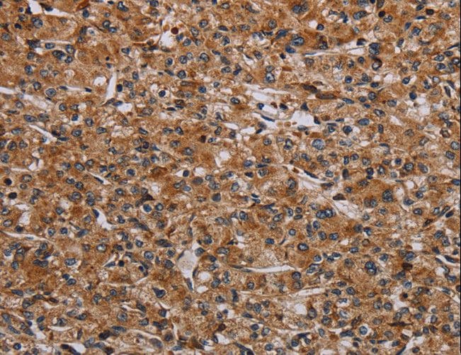 RPS6KB2 / S6K2 Antibody