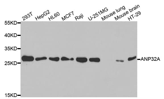 PHAP1 / ANP32A Antibody