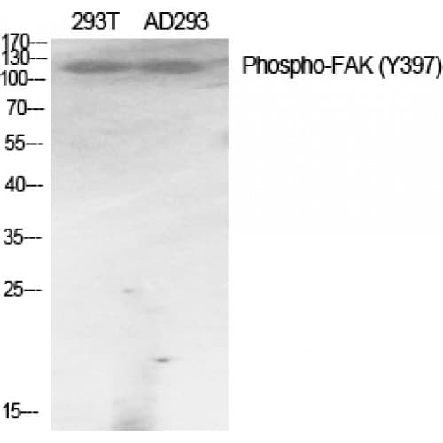 FAK / Focal Adhesion Kinase Antibody (340-420 aa)