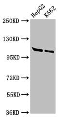 Polyclonal Rabbit anti-Human SMARCA3 / HLTF Antibody (IHC, WB)