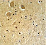 FAM92A1 Antibody (aa113-141)