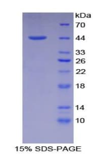 Mouse NPPA / ANP Protein (Recombinant His-GST)