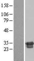 ZNF174 Protein (Over-Expression Lysate Myc-DDK (Flag))