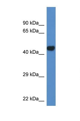 PCYT2 / ET Antibody (aa109-158)