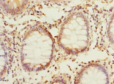 PPAP2C Antibody (aa109-162)