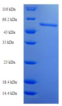 Human FIBP Protein (Recombinant His-SUMO)