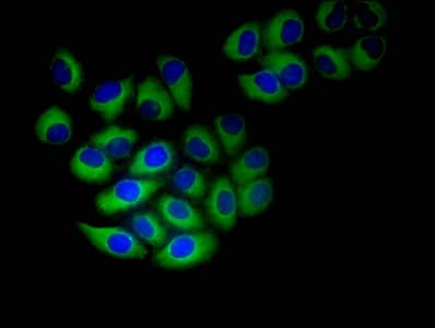Polyclonal Rabbit anti-Human NINJ1 / Ninjurin Antibody