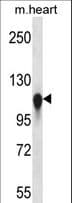 Polyclonal Rabbit anti-Human KIF5C Antibody (aa758-786, WB)