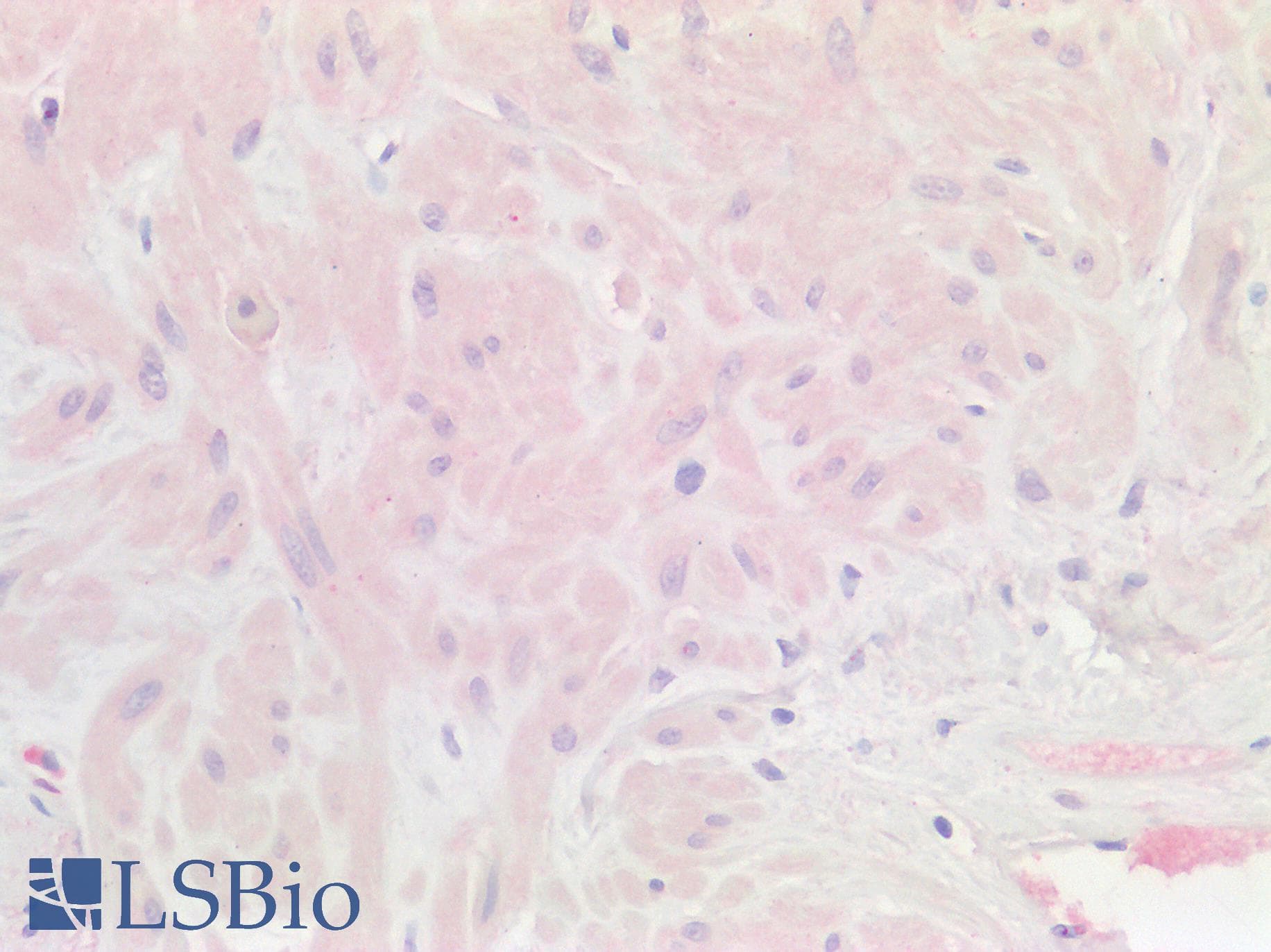 Polyclonal Rabbit anti-Human HS2ST1 Antibody (aa252-301, IHC, WB)