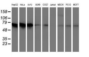 AICAR / ATIC Antibody (clone OTI1D2)