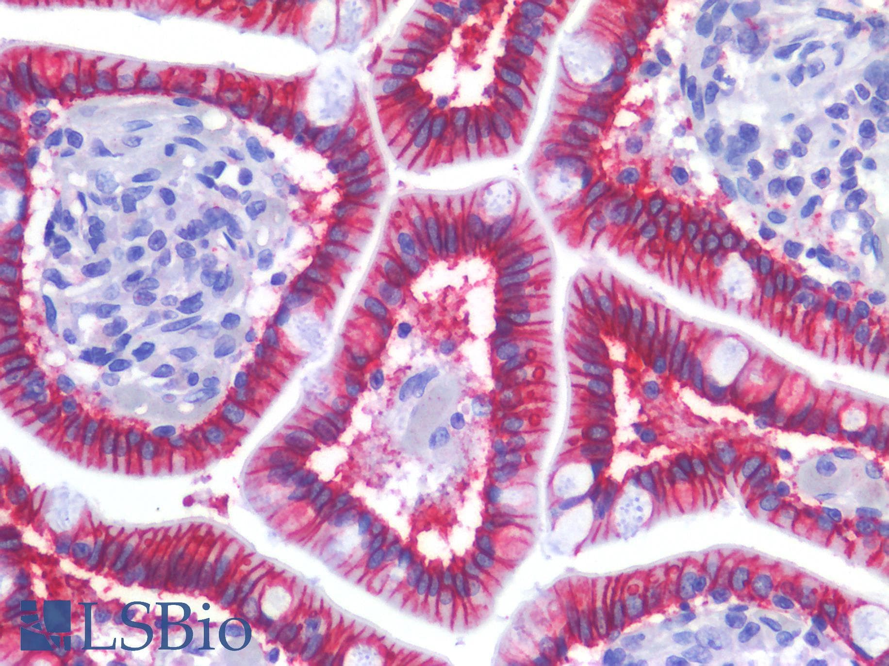 PathPlus™ CDH17 / Cadherin 17 Antibody (clone 1H3)