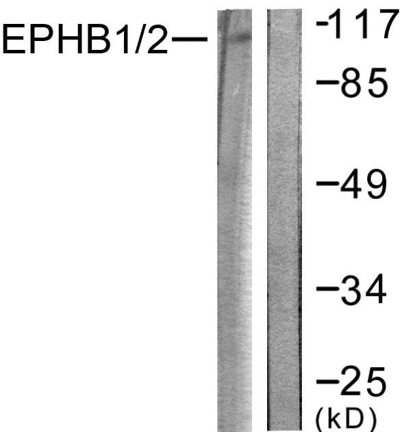 Ephrin B1+B2 Antibody (p594/604)