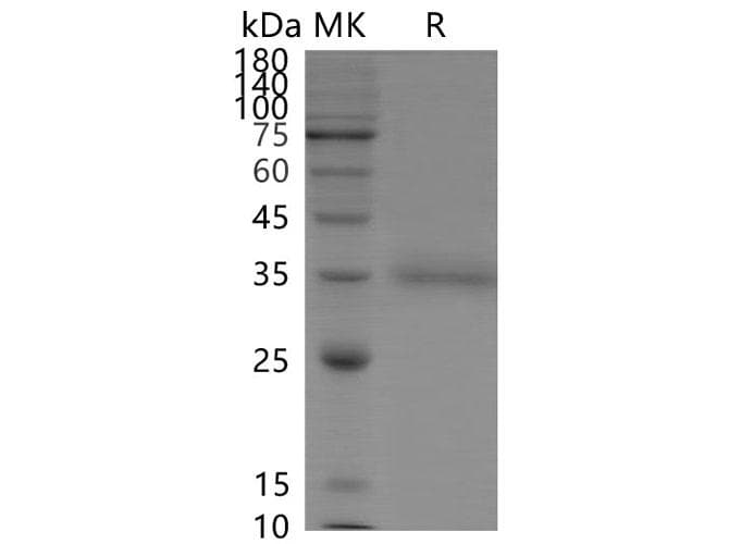 Coronavirus SARS-CoV-2 SARS-CoV-2 Spike Glycoprotein (Recombinant His,C-terminus)