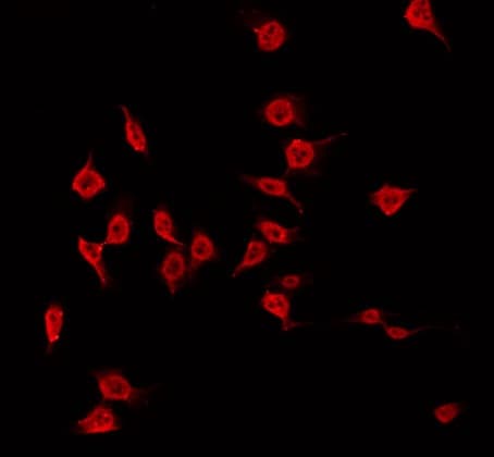 Polyclonal Rabbit anti-Human MAST3 Antibody (IF, WB)